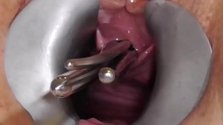 Amateur FreyjaAnalslut: fimbo katika Freyja ya pisshole